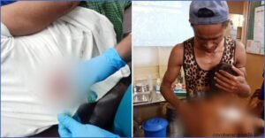  দুই শিশুসহ গুলিবিদ্ধ ৩ রোহিঙ্গা ক্যাম্পে গোলাগুলি